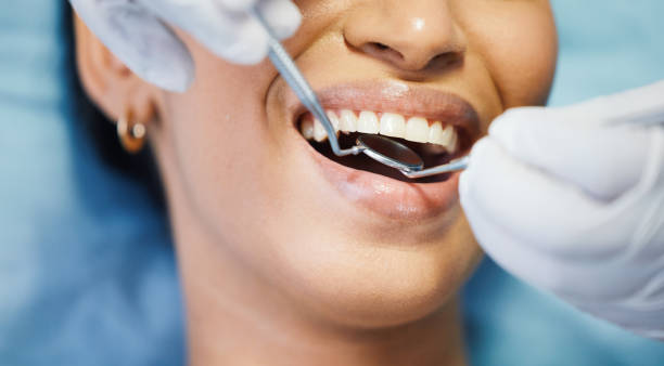 Best Broken Tooth Emergency  in Wakeman, OH